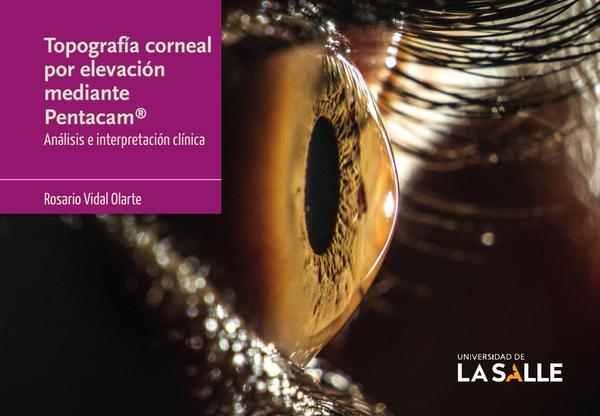 Topografía corneal por elevación mediante Pentacam®:Análisis e interpretación clínica